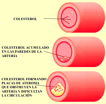 colesterol3