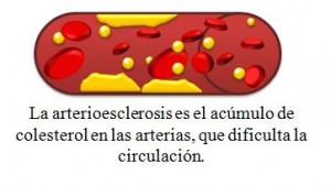 colesterolarteriosclerosis
