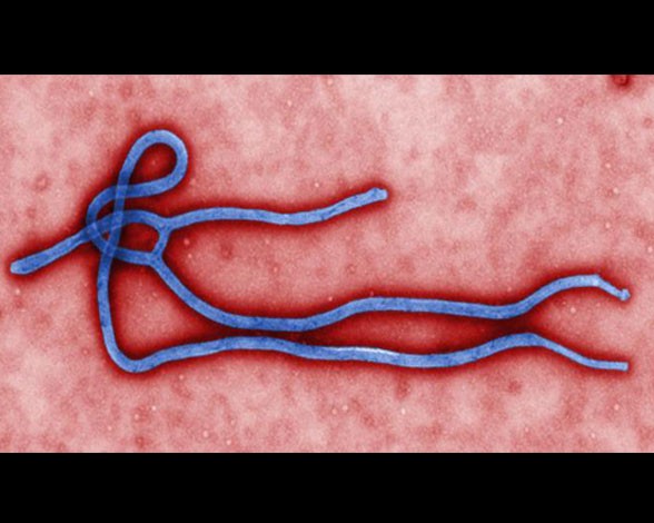 virus-ebola-virus-ebola-6686